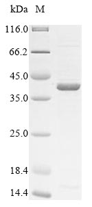Bacteria porB protein