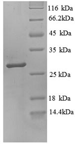 Human PRSS3 protein