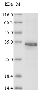 Plant Vespa magnifica Hyaluronidase protein