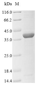 Bacteria porB protein
