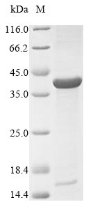 Bacteria porB protein