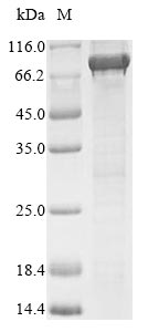 E. coli ldcC protein