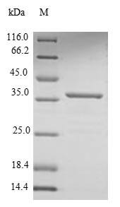 Virus cagA cag26 cai HP_0547 protein