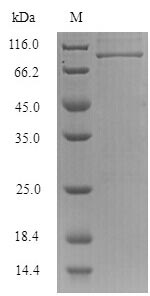 Virus NP protein
