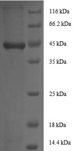 Human IGF1 protein