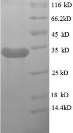 Virus Hirudo medicinalis Hirudin variant-1 protein