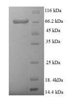 Zebrafish d2hgdh protein