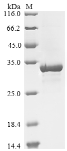 Virus Zea mays Endochitinase B protein