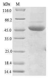 Virus Measles virus Nucleoprotein(N) protein