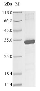 Human KIR2DS3 protein