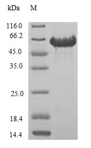 Human CA9 protein
