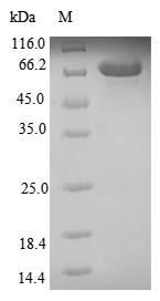 Human CA9 protein