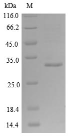 Human ACVR2B protein