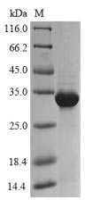 Plant alpha-amylase inhibitor CMx1/CMx3 protein