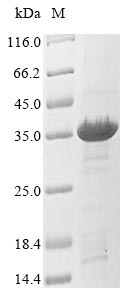 Virus tetM protein