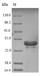 Human SNRNP70 protein