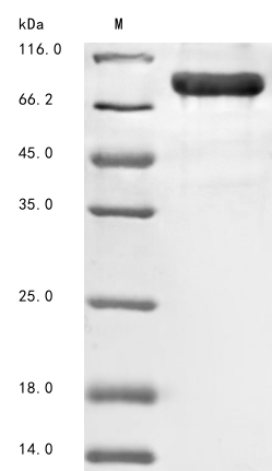 Mouse Ripk1 protein