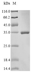 Reptile viral diarrhea virus Genome polyprotein protein