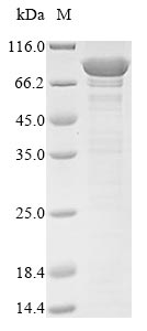 Human VPS35 protein