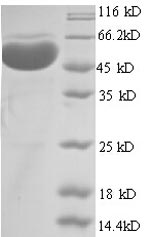 Human PRMT1 protein