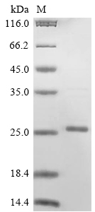 Human PLA2G12A protein