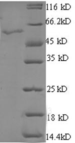 Human STARD7 protein