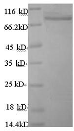 Human ANGPTL4 protein