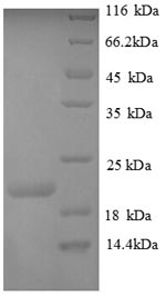 Human PLXNA1 protein