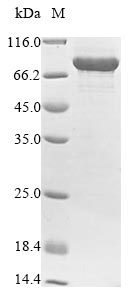 Human PADI4 protein