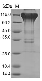 Human CSF1R protein