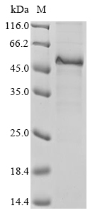 Human CTAG1A protein