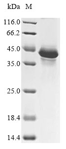 Human FSHR protein