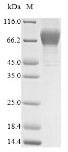 Human GUCY2C protein