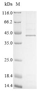 Human HAPLN1 protein