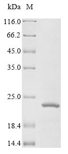 Human IGF1R protein