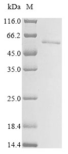 Human MAGEA1 protein