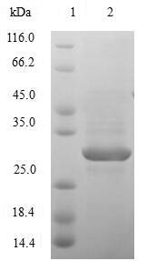 Human NPHS1 protein