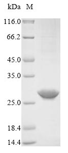 Human RCVRN protein