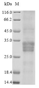 Rat Osm protein