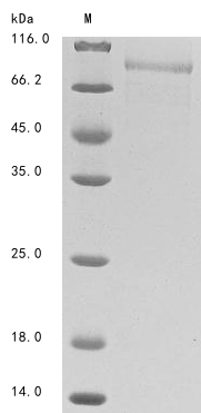 Human TIMD4 protein