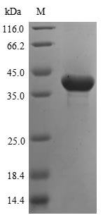 Human ASPA protein
