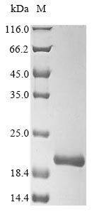 Human ATP5D protein