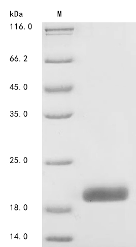 Human CSF1 protein