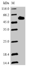 Human DMP1 protein