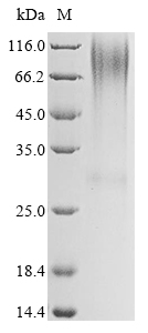 Human GCGR protein