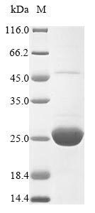 Human GSTP1 protein