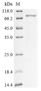 Human KRT85 protein