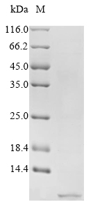 Human PYY protein
