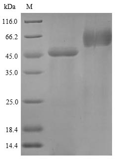 Human SERPINB2 protein