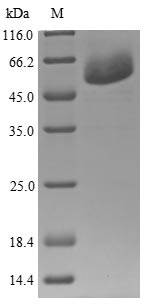 Human WARS protein